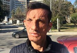 Türkiye'nin ilk yüz nakillisi Uğur Acar: Tek isteğim evlenmek