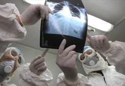 Pandemi nedir? Corona Virüsü Dünya Sağlık Örgütü tarafından Pandemi ilan edildi