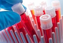 CRP 125 Nedir? CRP 125 Kaç Olmalı? Yüksekliği Ve Düşüklüğü Nedenleri