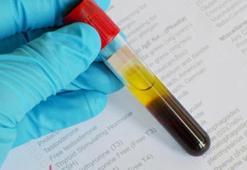 Dhea So4 Nedir? Dhea So4 Kaç Olmalı? Yüksekliği Ve Düşüklüğü Nedenleri