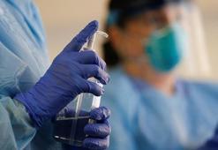 Son dakika! Coronada son durum: Ağır hastalarda olumlu sonuç alındı