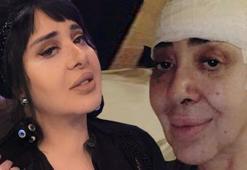 Modacı Nur Yerlitaş kimdir, aslen nereli? Nur Yerlitaş'ın hastalığı neydi neden vefat etti?