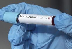 Remdesivir ilacı nedir, nasıl kullanılıyor? Remdesivir ilacı coronavirüs tedavisinde işe yarıyor mu?