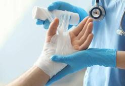 Yanığa Ne İyi Gelir? Yanık Dereceleri Nelerdir? Yanığa Doğal Tedavi Yöntemleri