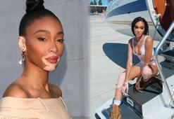 Winnie Harlow karantina sonrası tatile çıktı