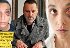 Deniz Bulutsuz'un darp edilmiş haline ait fotoğraflar ortaya çıktı