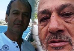 Kardeşini öldüren ağabey: Cinsel organını gösterip, 2 bıçakla üzerime yürüdü
