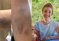 Son dakika: Corona hastası genç doktora kabusu yaşattı! İşte doktorun yaşadıkları...