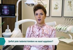 Şeffaf plak tedavisi kimlere ve nasıl uygulanır?