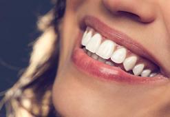 Kişiye özel gülüş tasarımında estetik uygulamalar