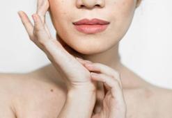 Hamilelik döneminde neden ciltte lekelenmeler olur?