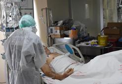 Covid-19 geçiren iki hastada görüldü! Uzmandan kritik uyarı