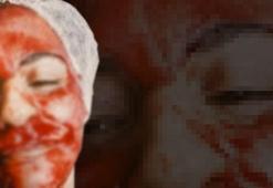 Yüzünü mahvettiler! Üstüne bir de para istediler