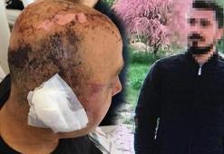 Polis memurunu telsizle döven saldırgana 8 yıl hapis istemi