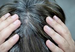 Genç yaşta saç beyazlamasını bu yöntem durdurabilir