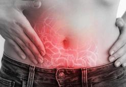 Bağırsak Hastalıkları Nelerdir? Tüm İnce Ve Kalın Bağırsak Hastalıkları