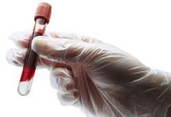 Demir eksikliği belirtileri ve nedenleri nelerdir? Demir eksikliğine iyi gelen besinler