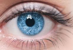 Keratokonus Nedir, Belirtileri Nelerdir? Keratokonus Tedavisi Nasıl Yapılır?