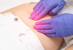 Apandisit Ne Tarafta Olur? Apandisit Ağrısı Nereye Vurur, Nasıl Geçer?