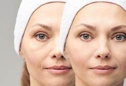 Göz Altı Işık Dolgusu Nedir, Nasıl Yapılır? Kimler Göz Altı Işık Uygulaması Yaptırabilir?