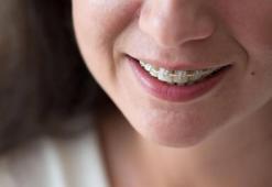 Maskeli yaşam ortodontik tedavileri nasıl etkiledi?