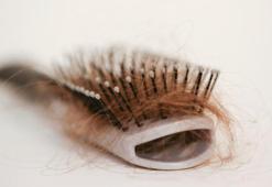 Saç Neden Dökülür? Saç Dökülmesi Nedenleri Nelerdir, Nasıl Engellenir?