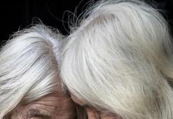 Beyaz Saç Nasıl Siyahlaşır? Beyazlamış Saçlar Nasıl Eski Haline Döner?