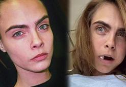 Cara Delevingne dişçi koltuğundan paylaştı: Çok ağladım