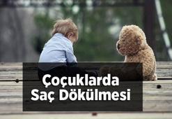 Çoçuklarda Saç Dökülmesi Nedenleri Nelerdir?