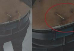 Çamaşır ipiyle tedavi skandalı! Belinde iki delik açıp yaptılar