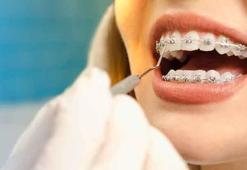 Dişlerdeki estetik görünüm sosyal ilişkileri de etkiler mi?