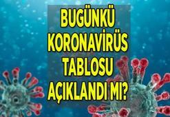 Son dakika haberi: 25 Temmuz koronavirüs tablosu (bugünkü)! Türkiye korona vaka sayısı ve ölü sayısı kaç oldu 2021?