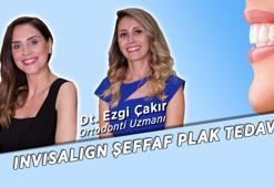 Şeffaf Plak ile Telsiz Ortodontik Tedavi (Invisalign) | Diş Tedavileri