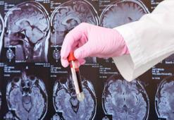 Türkiye'de 700 bin kişi mücadele ediyor! En az iki kat artacak