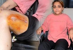 Eski eşinin vurduğu Derya, tekerlekli sandalyeye mahkum oldu
