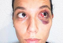 ‘Yakasından göğsüne kadar kan vardı’