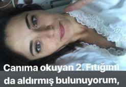Aslıhan Gürbüz'ün ameliyat sonrası dönüşü muhteşem olacak