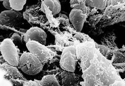 Avrupa'yı yerle bir eden hastalık: Veba