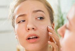 Cilt lekelerine neden olan 6 faktör