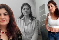 Yaptırdığı estetik ameliyatlar kabusu oldu!