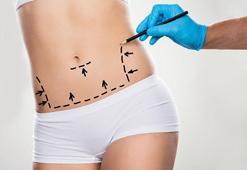 Karın germe ameliyatında merak edilenler