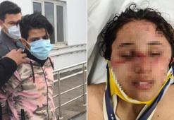 7 aylık hamile eşe SMS işkencesi! Vücudunda sigara söndürdü, bıçakladı, darp etti