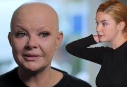 Gail Porter: Beni hiçbir şey yıkamaz!