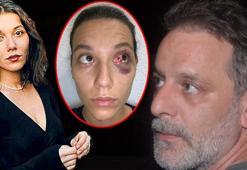 Deniz Bulutsuz-Ozan Güven davasında şoför tanık olarak dinlendi!