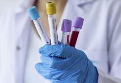 ⁬Endemi nedir, ne demek? Endemi pandemi farkı ne?