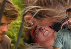 Survivor'da ikinci eleme adayı belli oldu! Nisa'nın sakatlığına Barış'ın gözyaşları damga vurdu