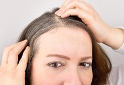 Beyazlayan saç eski rengine nasıl döner? Uzmanlar açıkladı...