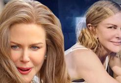 Nicole Kidman'in son hali gündem oldu! 'Lütfen yeter artık'