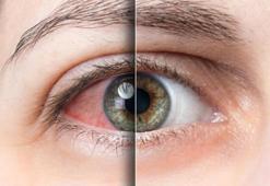 Gözleri bahar alerjisinden korumanın 8 yolu