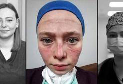 Türkiye'nin hafızasına kazınan fotoğraf! Seher hemşire: Maske kalktı ama izi ve hatıraları bizimle